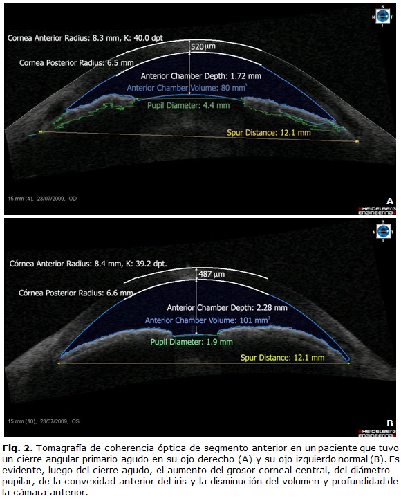 f0209312