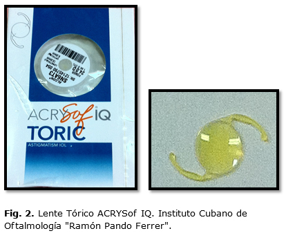 Tipos de discount lentes intraoculares pdf