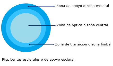 Colocador de online lentillas